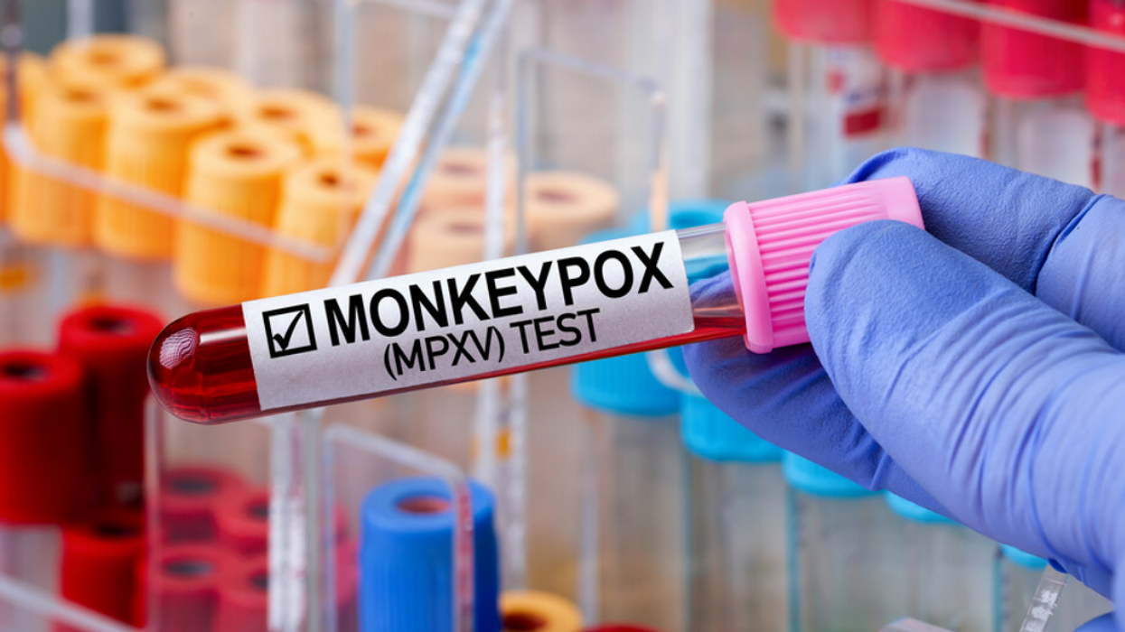 Une éprouvette avec une étiquette indiquant « Monkeypox ».