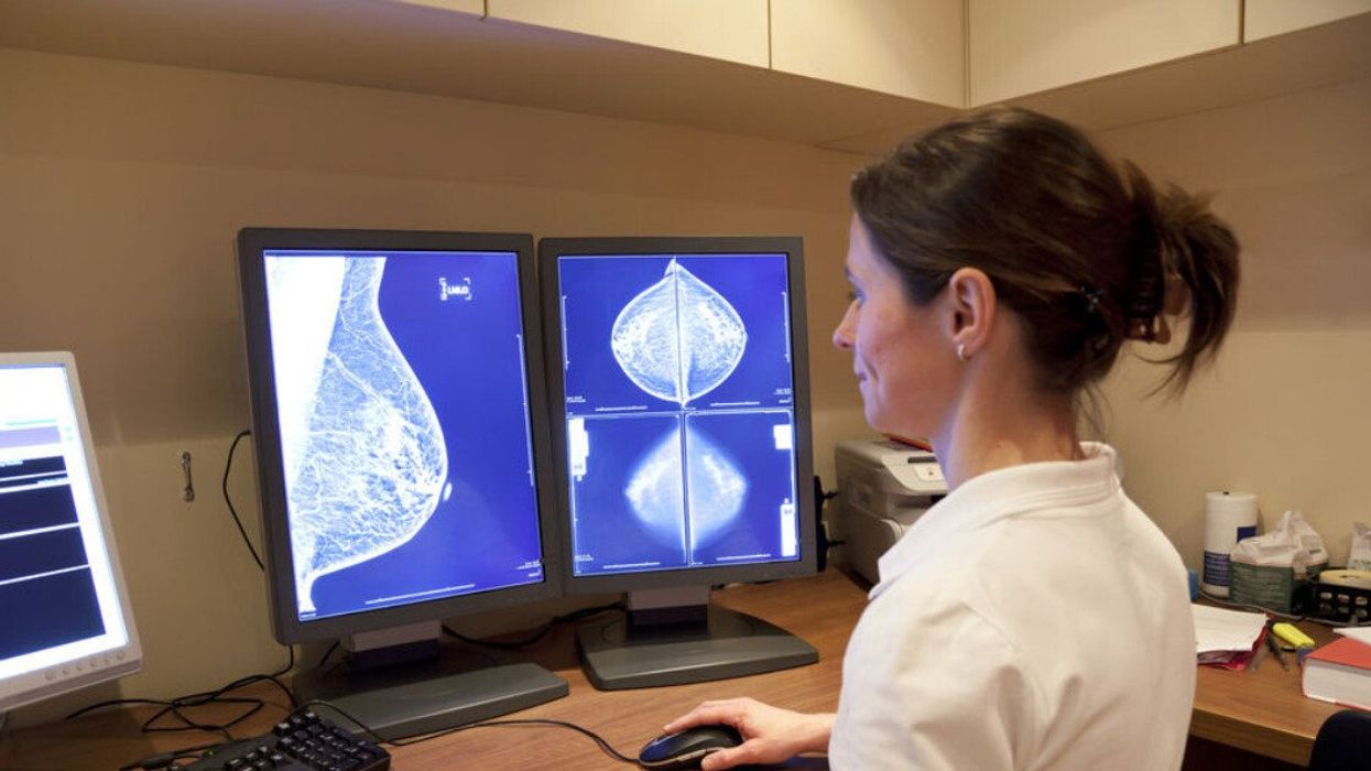 Une personne regarde des résultats d'examen de dépistage de cancer du sein sur des écrans d'ordinateur.