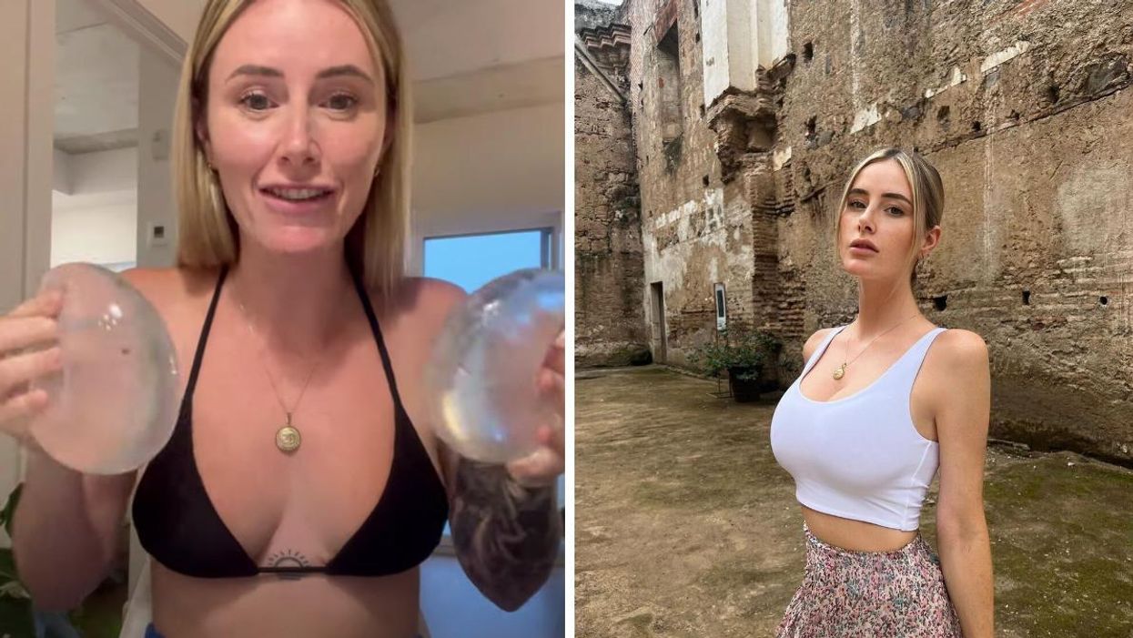 Vidéo de Vanessa Sicotte sur le retrait de ses implants mammaires. Droite : Vanessa Sicotte.