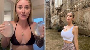 Vanessa de la saga Sunwing vend ses anciens implants et s'ouvre ...