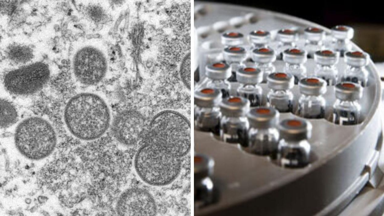 Virus de la variole du singe. Droite : flacons de vaccin.
